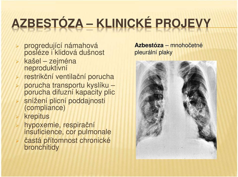 kapacity plic snížení plicní poddajnosti (compliance) krepitus hypoxemie, respirační