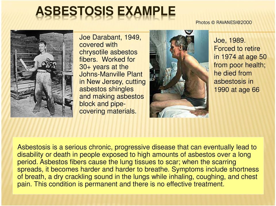 Forced to retire in 1974 at age 50 from poor health; he died from asbestosis in 1990 at age 66.