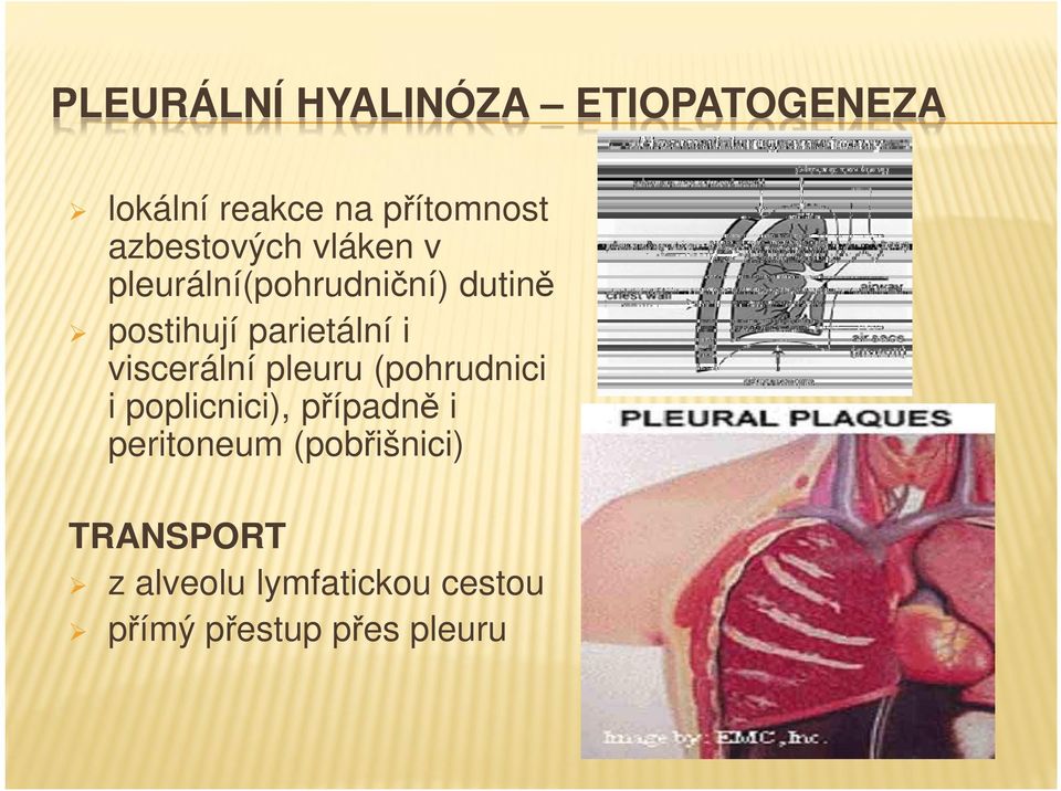parietální i viscerální pleuru (pohrudnici i poplicnici), případně i