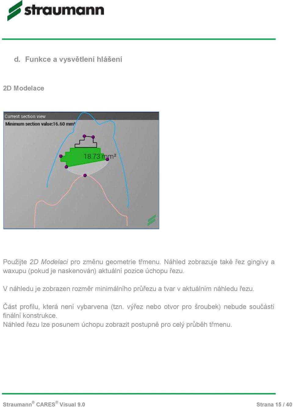 V náhledu je zobrazen rozměr minimálního průřezu a tvar v aktuálním náhledu řezu. Část profilu, která není vybarvena (tzn.