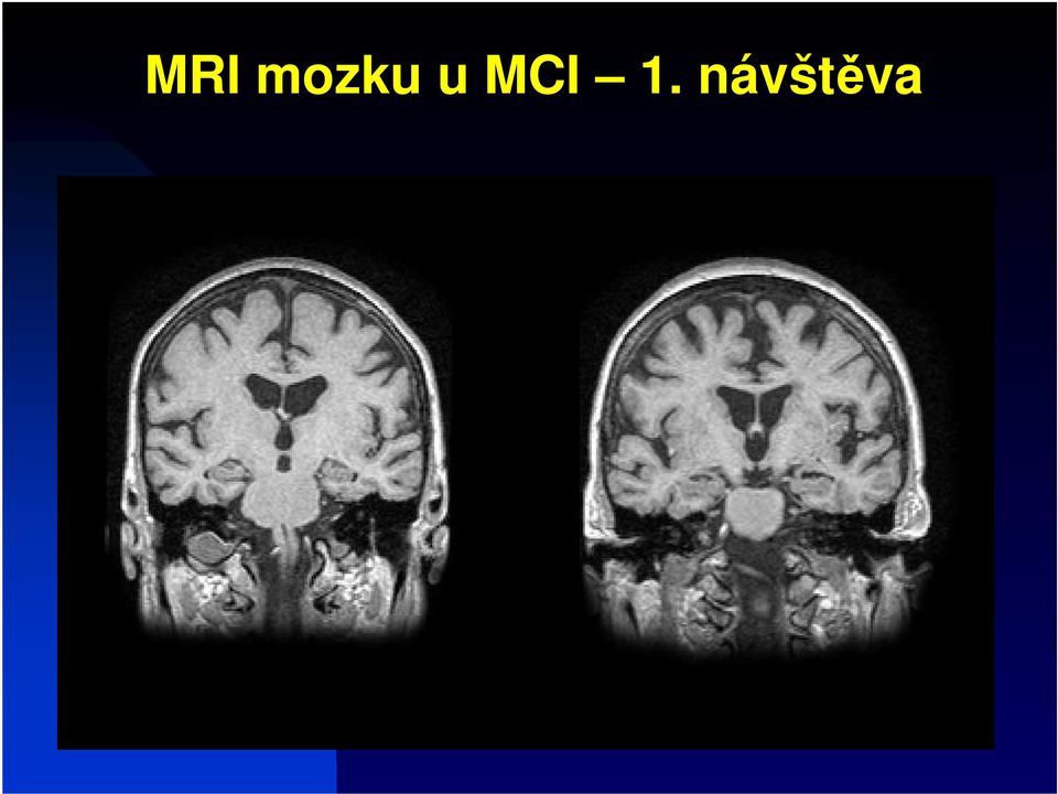 návštěva