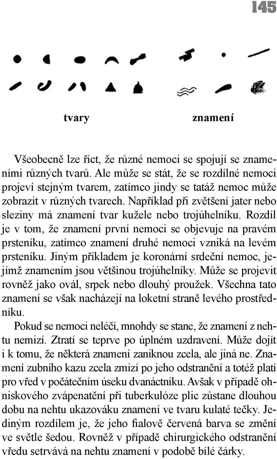 Například při zvětšení jater nebo sleziny má znamení tvar kužele nebo trojúhelníku.