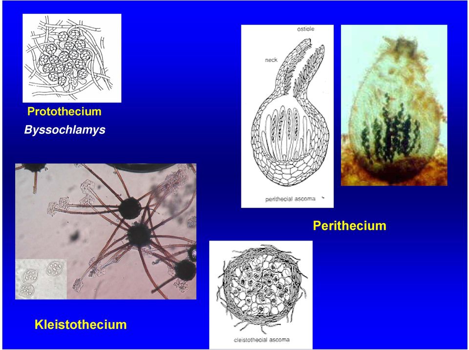 Perithecium