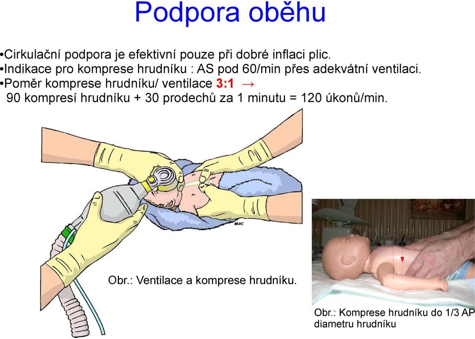 Poměr komprese hrudníku/ ventilace 3:1 90 kompresí hrudníku + 30 prodechů za 1