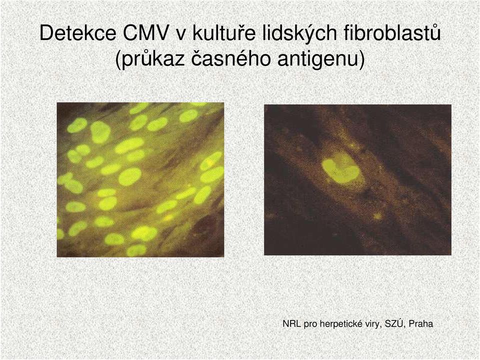 fibroblastů