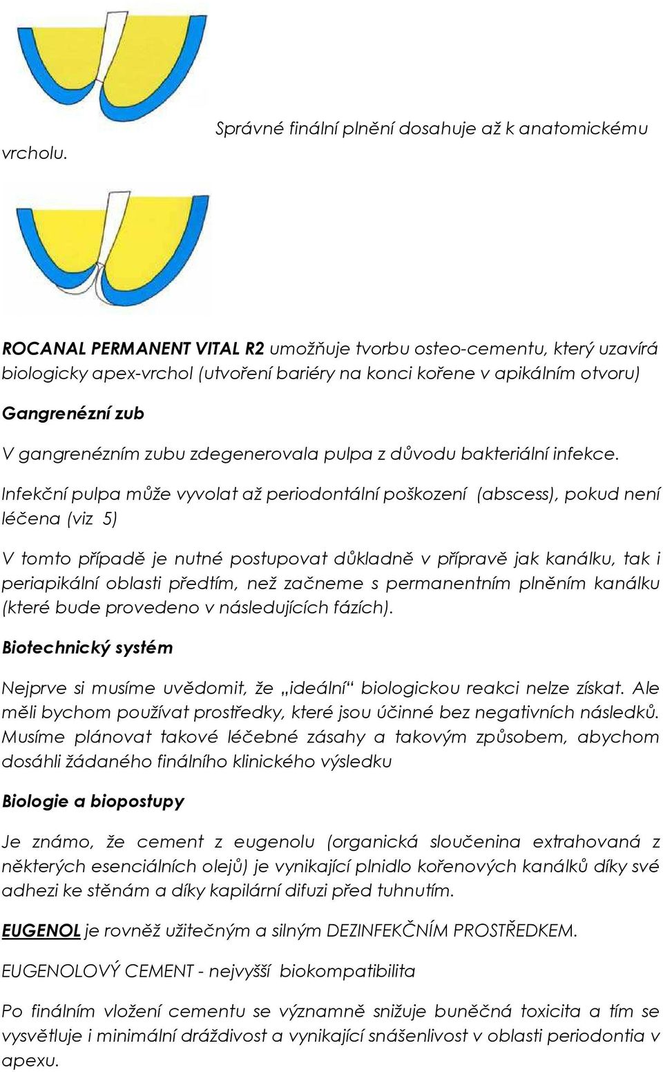 Gangrenézní zub V gangrenézním zubu zdegenerovala pulpa z důvodu bakteriální infekce.