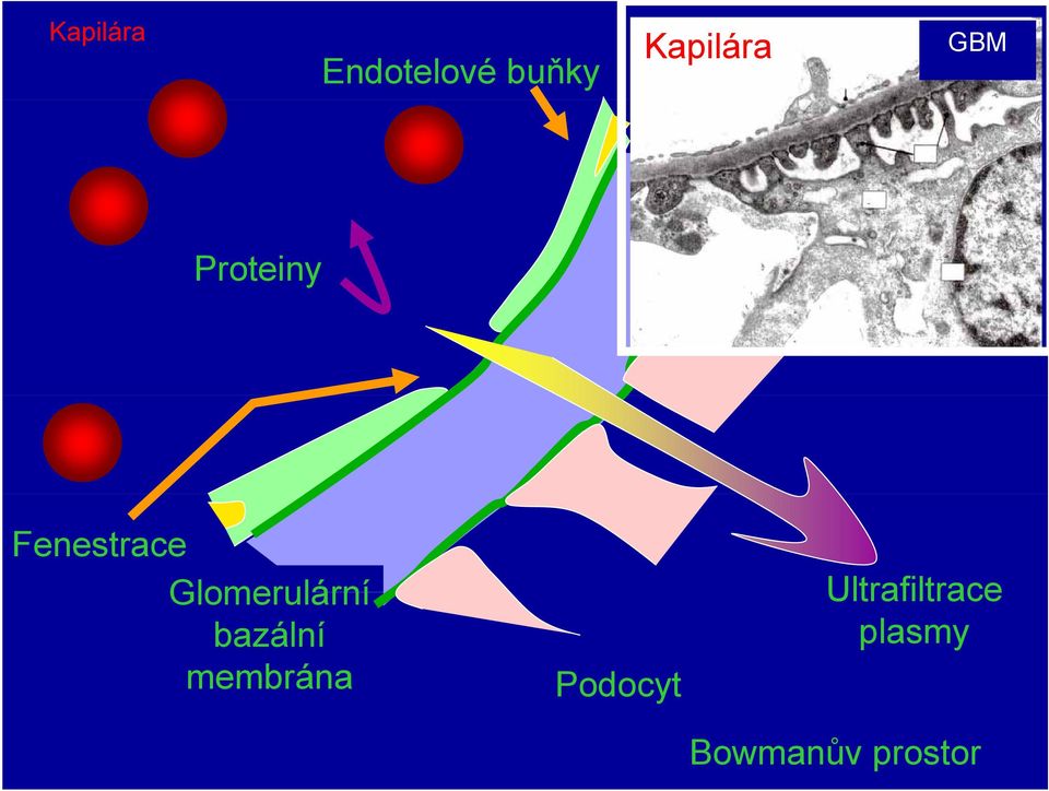 Glomerulární bazální membrána