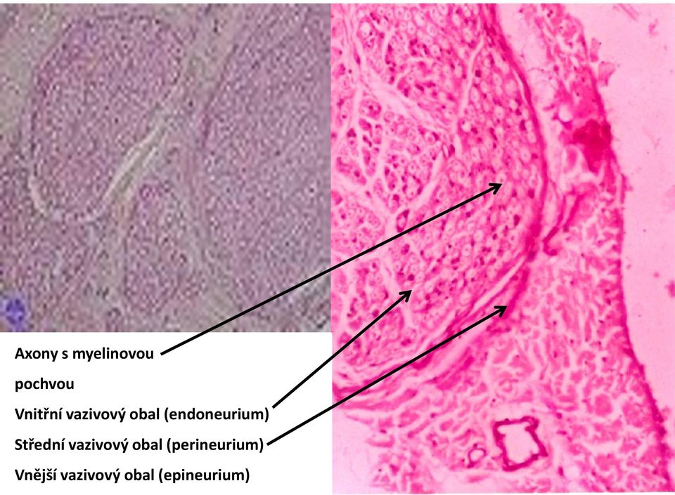 (endoneurium) Střední vazivový
