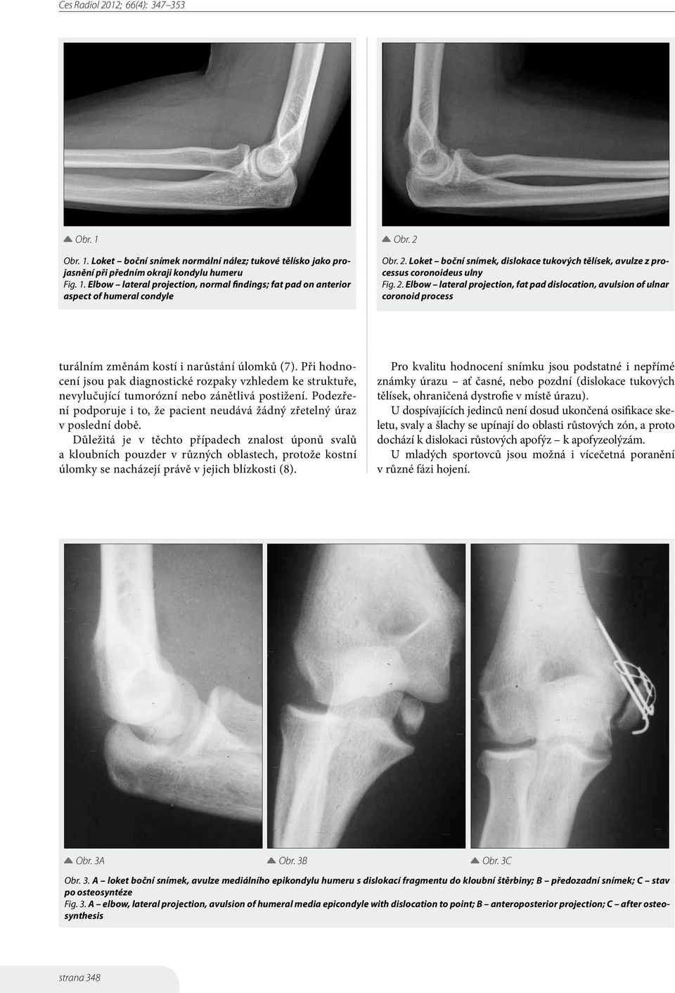 Při hodnocení jsou pak diagnostické rozpaky vzhledem ke struktuře, nevylučující tumorózní nebo zánětlivá postižení. Podezření podporuje i to, že pacient neudává žádný zřetelný úraz v poslední době.