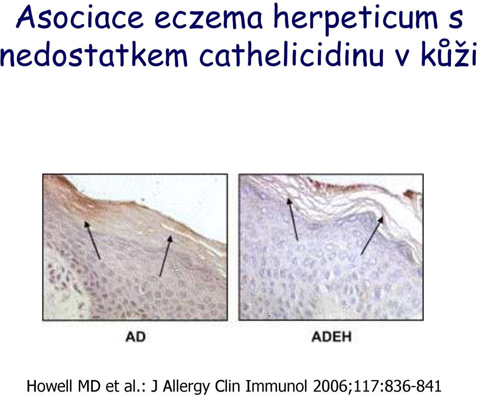 kůži Howell MD et al.