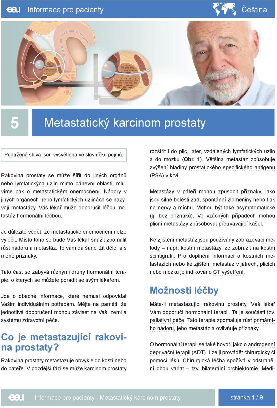 Nádory v jiných orgánech nebo lymfatických uzlinách se nazývají metastázy. Váš lékař může doporučit léčbu metastáz hormonální léčbou. Je důležité vědět, že metastatické onemocnění nelze vyléčit.