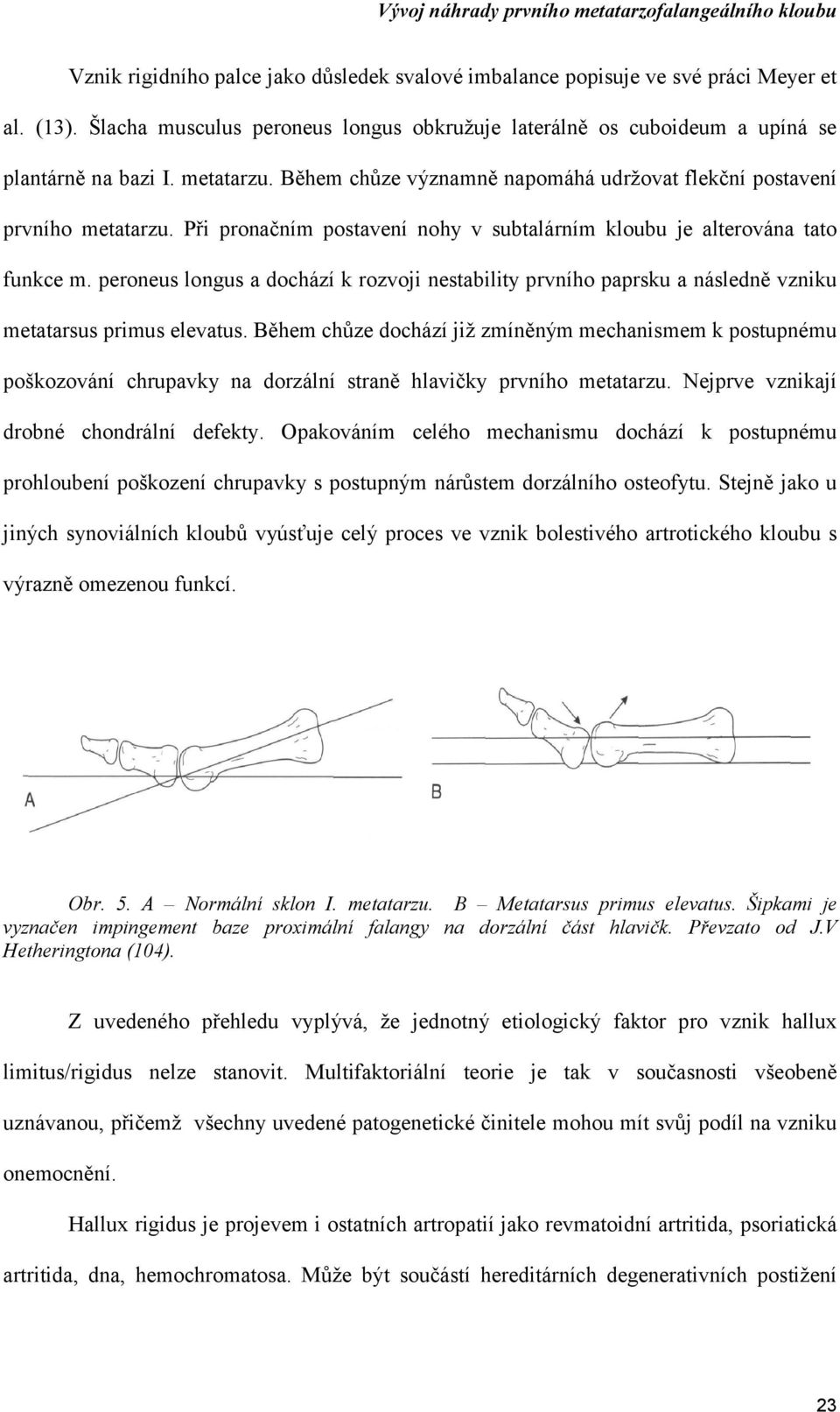 peroneus longus a dochází k rozvoji nestability prvního paprsku a následně vzniku metatarsus primus elevatus.