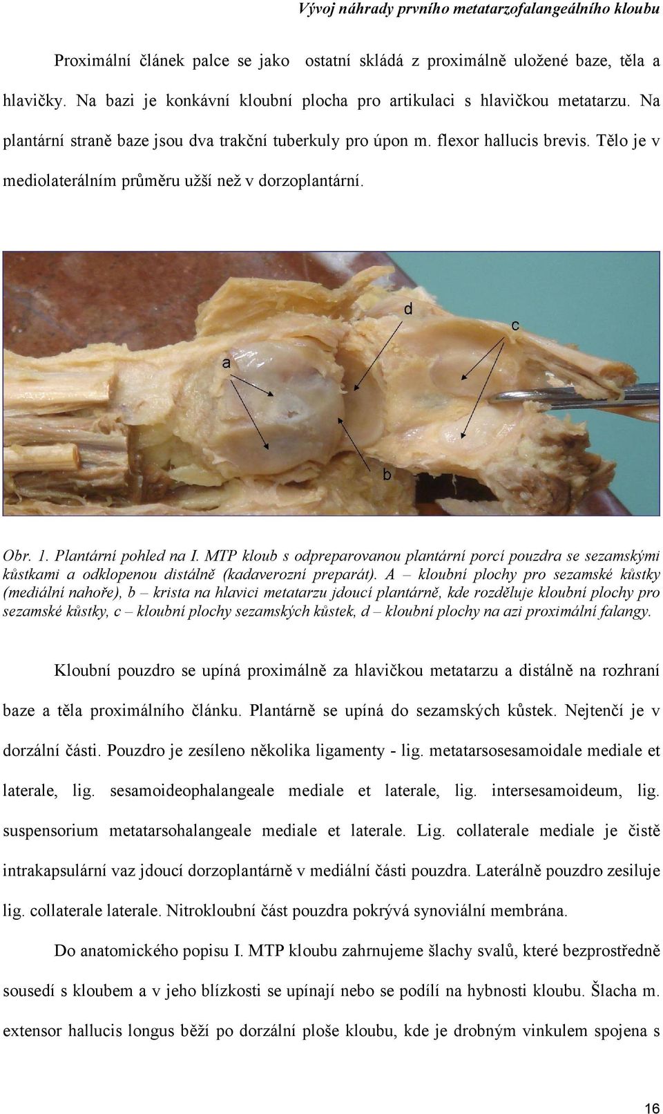 MTP kloub s odpreparovanou plantární porcí pouzdra se sezamskými kůstkami a odklopenou distálně (kadaverozní preparát).