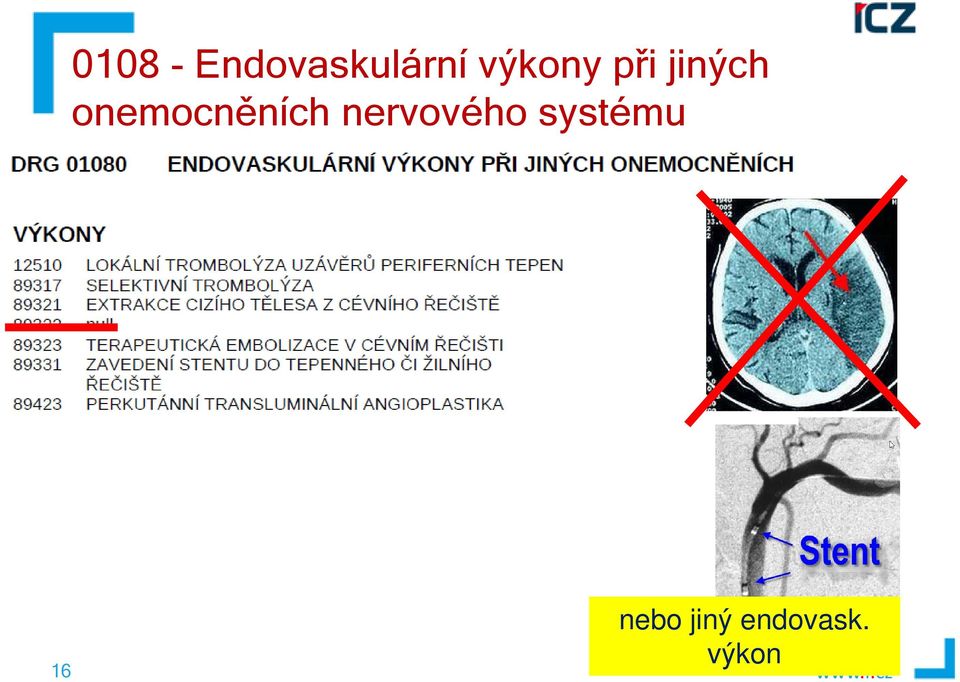 onemocněních nervového