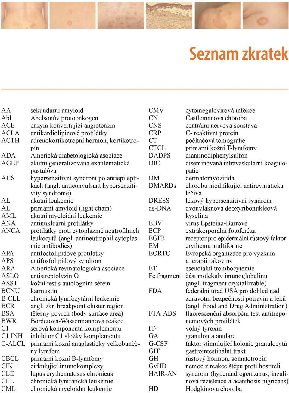 anticonvulsant hypersenzitivity syndrome) AL akutní leukemie AL primární amyloid (light chain) AML akutní myeloidní leukemie ANA antinukleární protilátky ANCA protilátky proti cytoplazmě