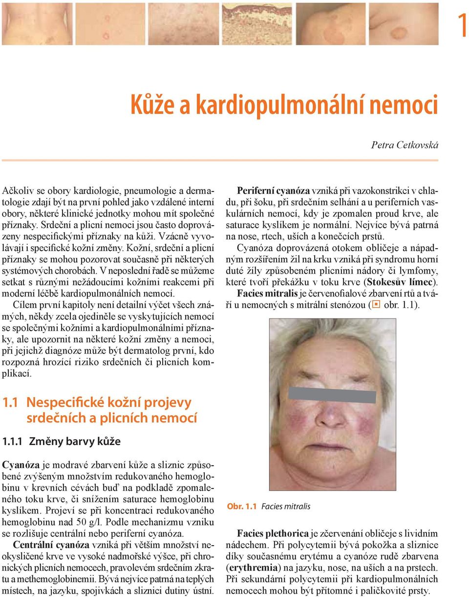 Kožní, srdeční a plicní příznaky se mohou pozorovat současně při některých systémových chorobách.