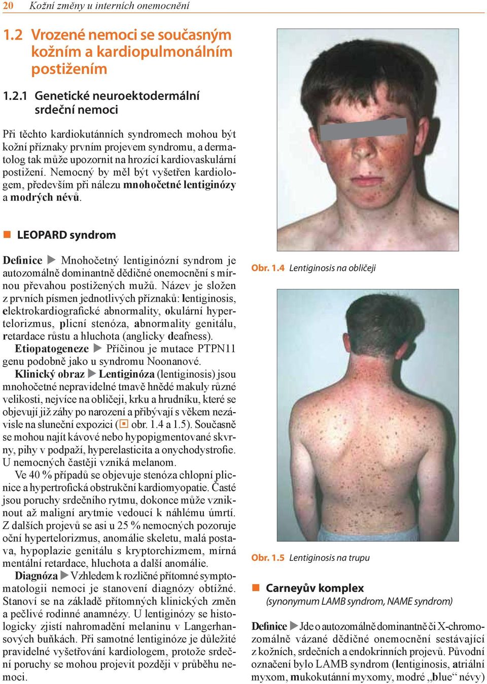 Nemocný by měl být vyšetřen kardiologem, především při nálezu mnohočetné lentiginózy a modrých névů.
