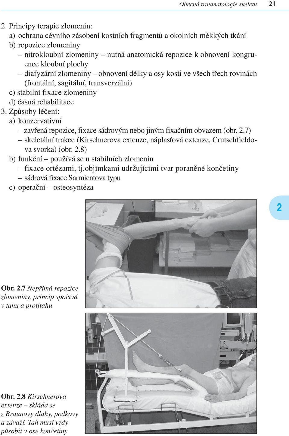 plochy diafyzární zlomeniny obnovení délky a osy kosti ve všech třech rovinách (frontální, sagitální, transverzální) c) stabilní fixace zlomeniny d) časná rehabilitace 3.