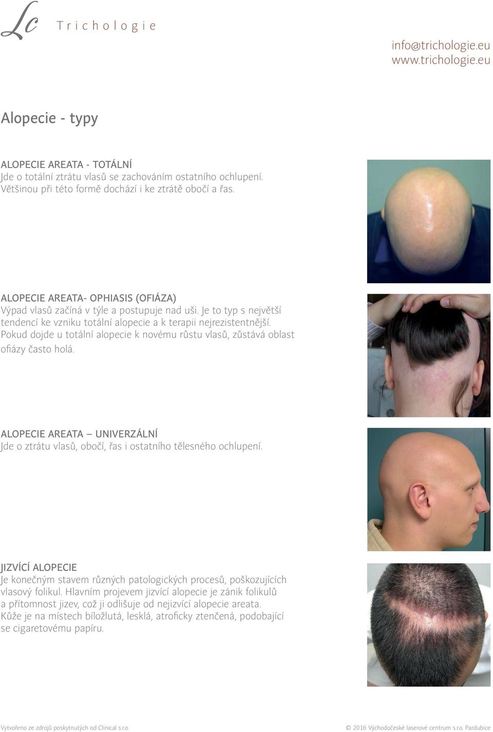 Pokud dojde u totální alopecie k novému růstu vlasů, zůstává oblast ofiázy často holá. Alopecie areata univerzální Jde o ztrátu vlasů, obočí, řas i ostatního tělesného ochlupení.