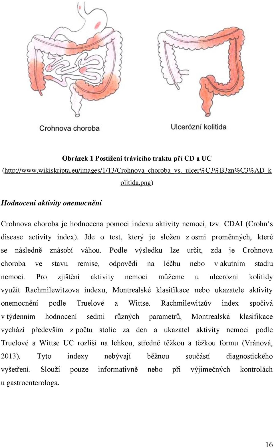 Jde o test, který je sloţen z osmi proměnných, které se následně znásobí váhou. Podle výsledku lze určit, zda je Crohnova choroba ve stavu remise, odpovědi na léčbu nebo v akutním stadiu nemoci.
