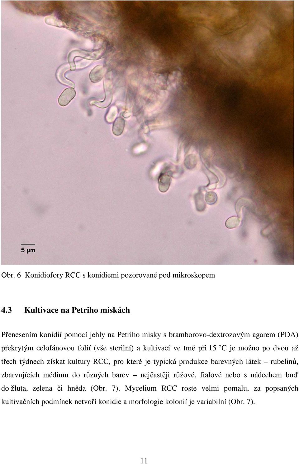 sterilní) a kultivací ve tmě při 15 C je možno po dvou až třech týdnech získat kultury RCC, pro které je typická produkce barevných látek rubelinů,