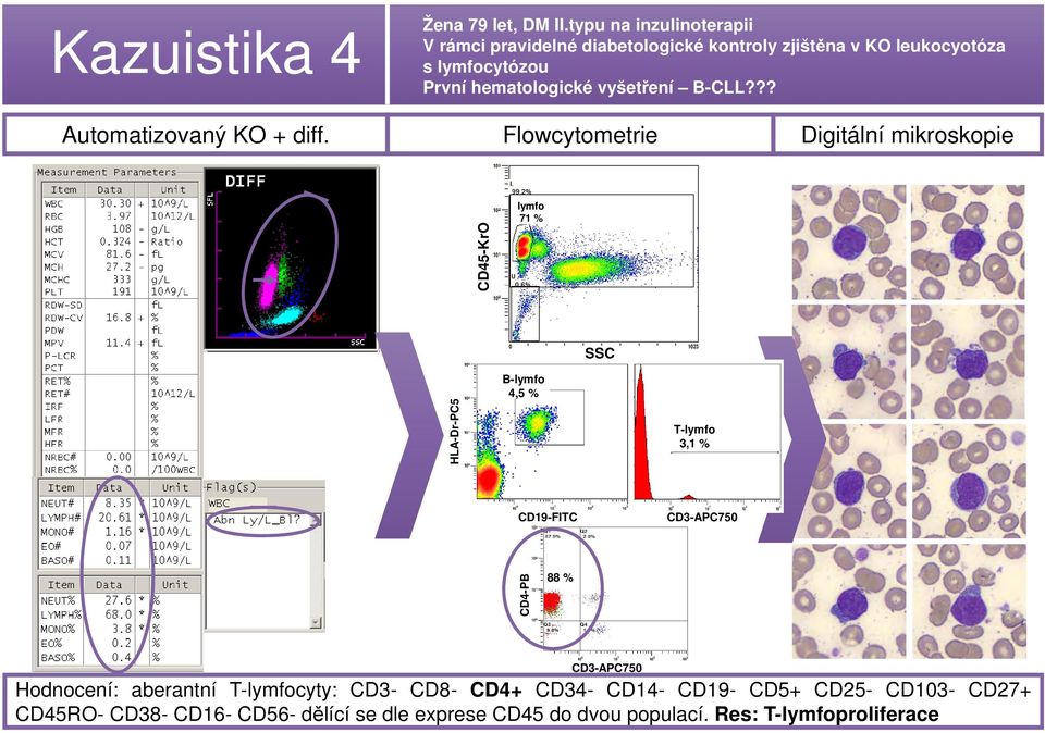vyšetření B-CLL??? Automatizovaný KO + diff.
