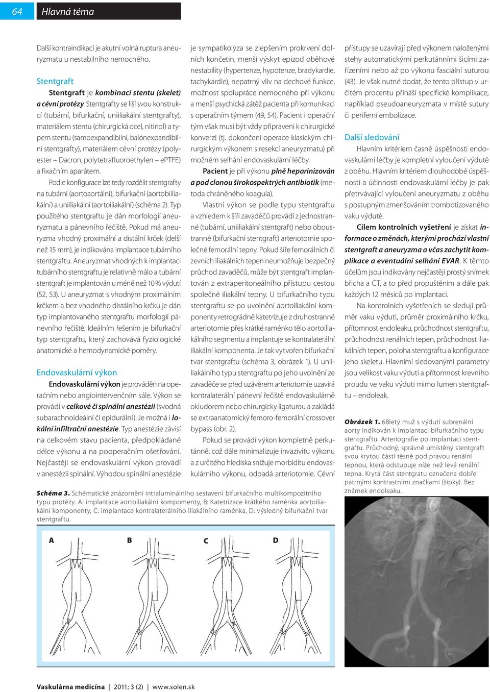 materiálem cévní protézy (polyester Dacron, polytetrafluoroethylen eptfe) a fixačním aparátem.