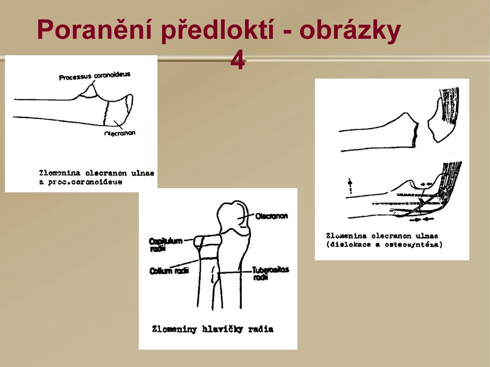 - obrázky