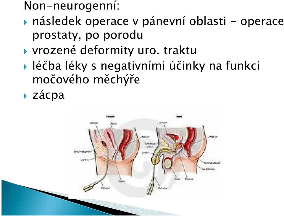 vrozené deformity uro.