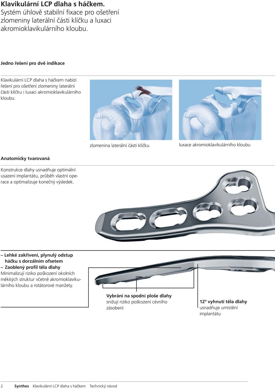 zlomenina laterální části klíčku luxace akromioklavikulárního kloubu Anatomicky tvarovaná Konstrukce dlahy usnadňuje optimální usazení implantátu, průběh vlastní operace a optimalizuje konečný