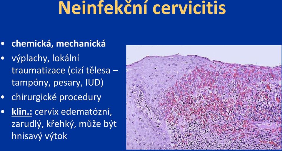 tampóny, pesary, IUD) chirurgické procedury klin.