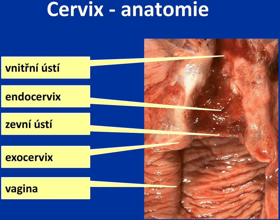 endocervix zevní