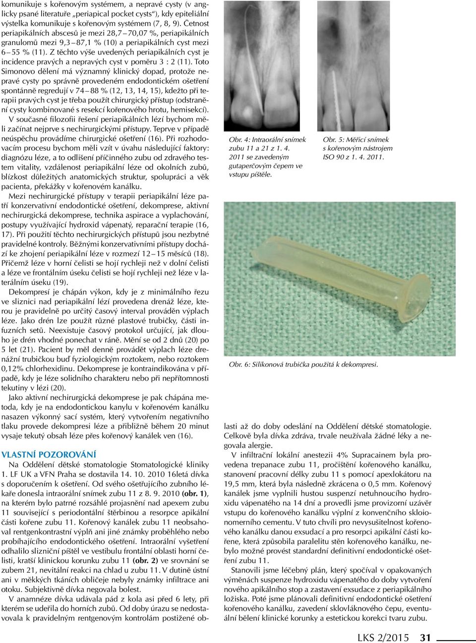 Z těchto výše uvedených periapikálních cyst je incidence pravých a nepravých cyst v poměru 3 : 2 (11).