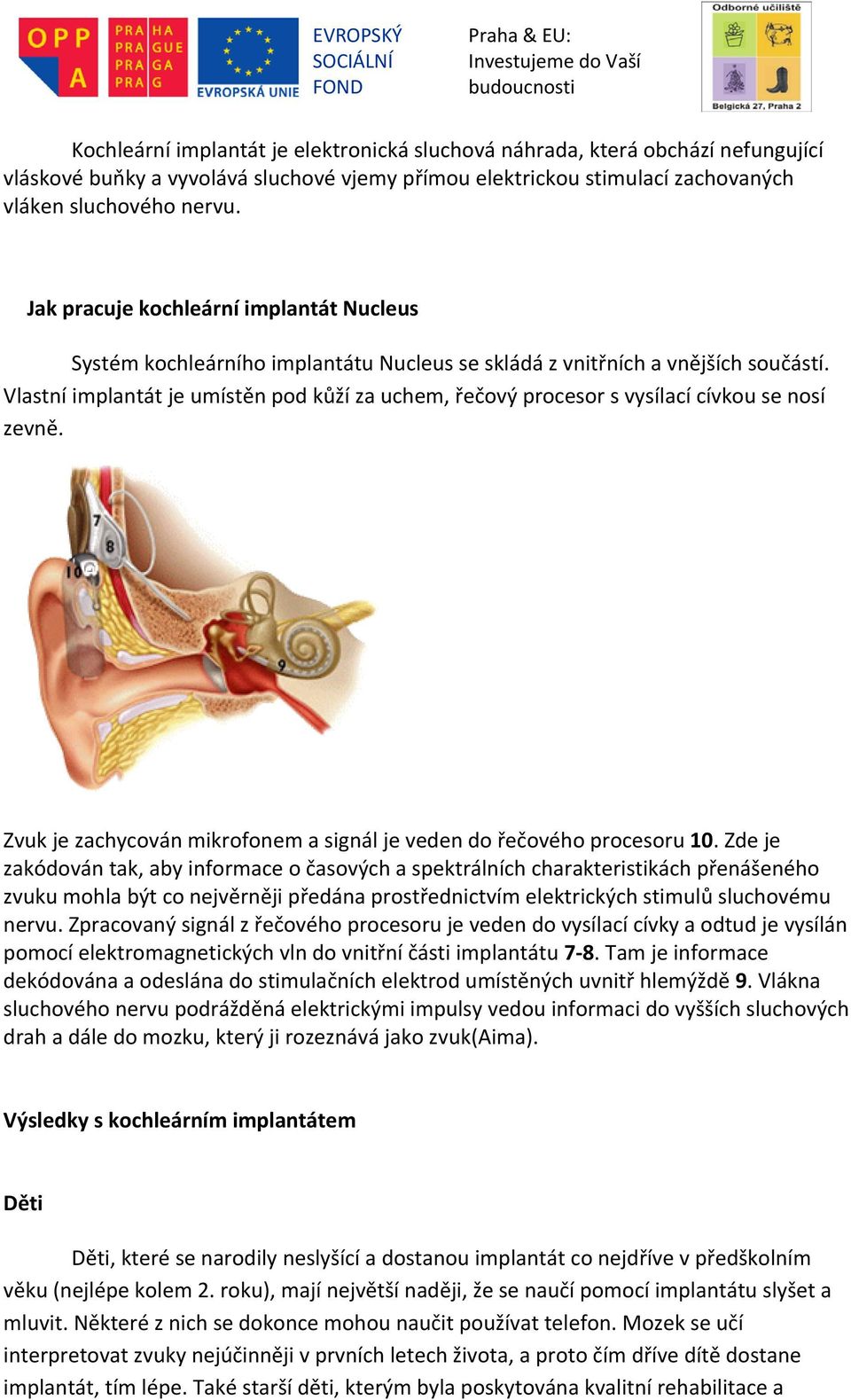 Vlastní implantát je umístěn pod kůží za uchem, řečový procesor s vysílací cívkou se nosí zevně. Zvuk je zachycován mikrofonem a signál je veden do řečového procesoru 10.