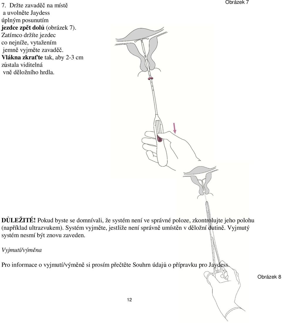 Obrázek 7 DŮLEŽITÉ! Pokud byste se domnívali, že systém není ve správné poloze, zkontrolujte jeho polohu (například ultrazvukem).