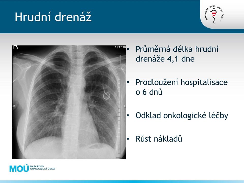 Prodloužení hospitalisace o 6