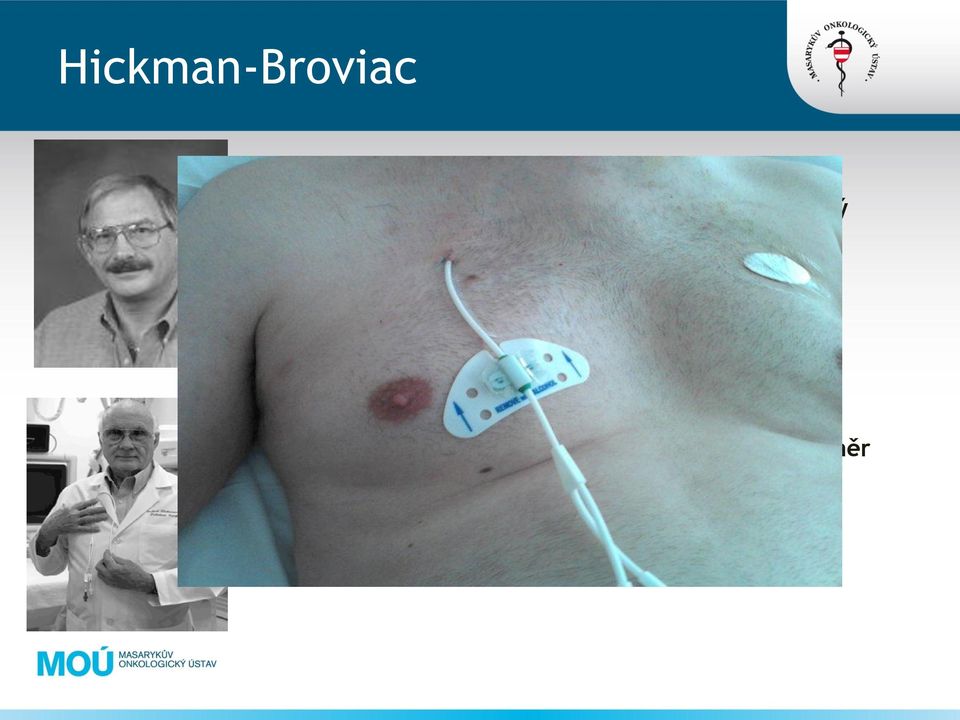 žilní katetr pro potřeby nutriční podpory 1973 Dr.