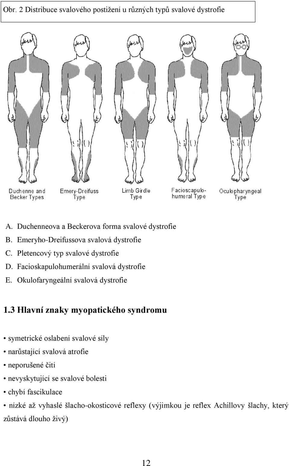 Okulofaryngeální svalová dystrofie 1.