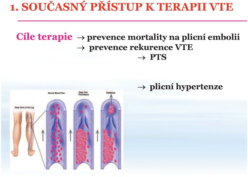 mortality na plicní embolii