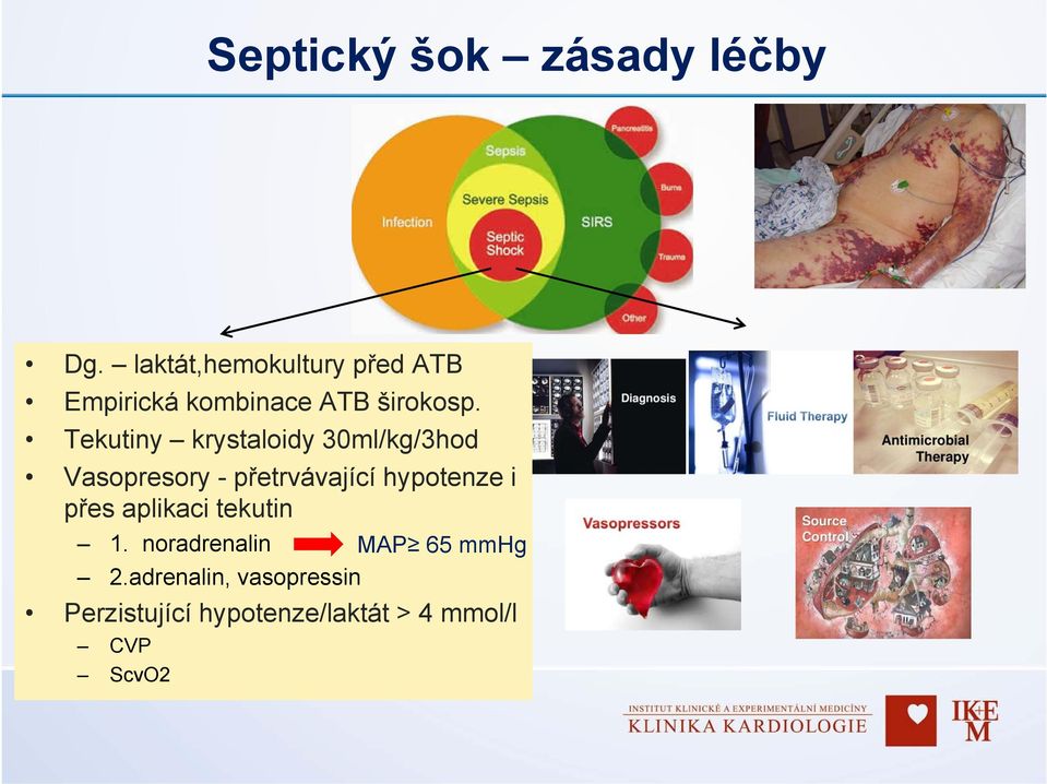 Tekutiny krystaloidy 30ml/kg/3hod Vasopresory - přetrvávající hypotenze