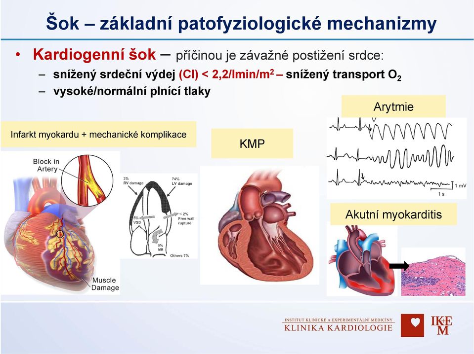 < 2,2/lmin/m 2 snížený transport O 2 vysoké/normální plnící