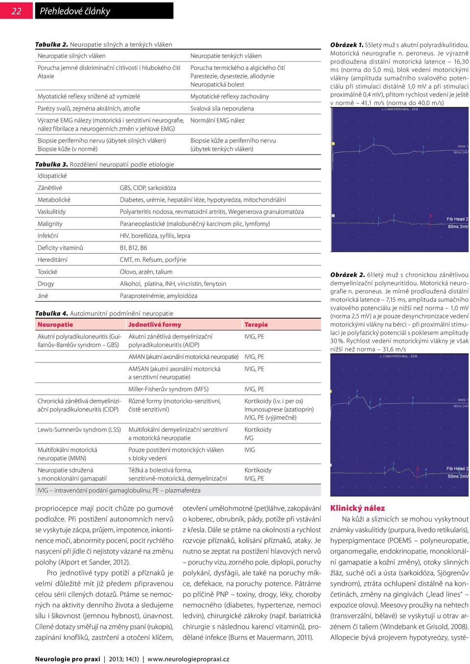 atrofie Výrazné EMG nálezy (motorická i senzitivní neurografie, nález fibrilace a neurogenních změn v jehlové EMG) Biopsie periferního nervu (úbytek silných vláken) Biopsie kůže (v normě) Neuropatie