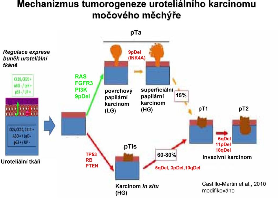 superficiální papilární 15% karcinom (HG) pt1 pt2 Uroteliální tkáň TP53 RB PTEN ptis 60-80% 5qDel,