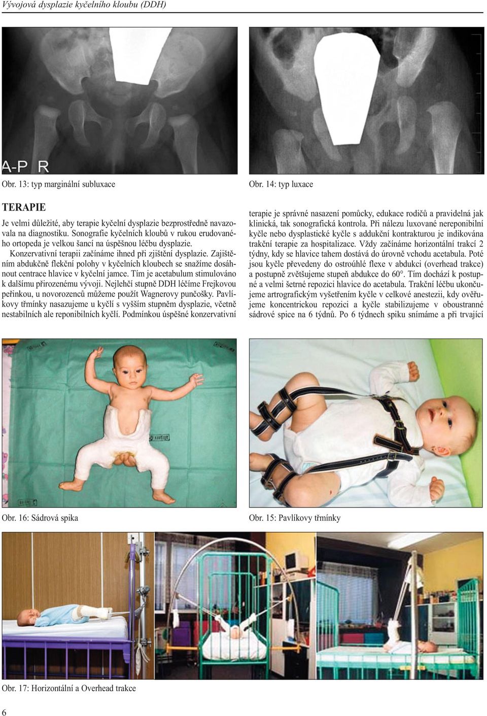 Zajištěním abdukčně flekční polohy v kyčelních kloubech se snažíme dosáhnout centrace hlavice v kyčelní jamce. Tím je acetabulum stimulováno k dalšímu přirozenému vývoji.