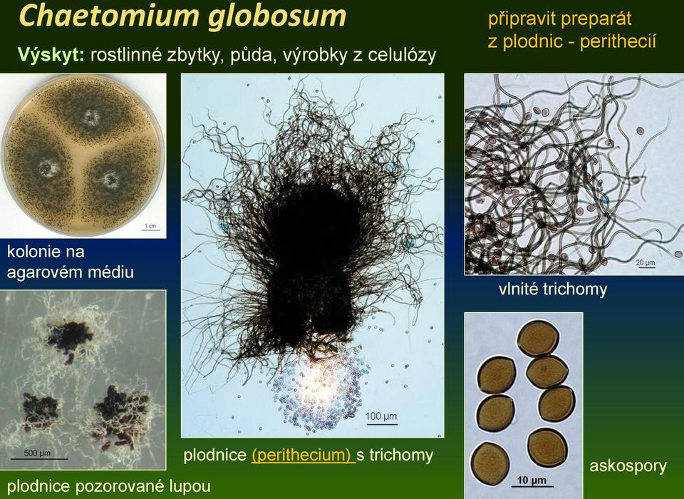 perithecií kolonie na agarovém médiu vlnité trichomy