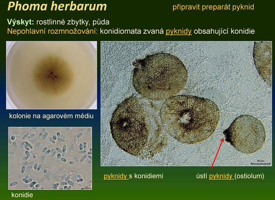 konidiomata zvaná pyknidy obsahující konidie kolonie