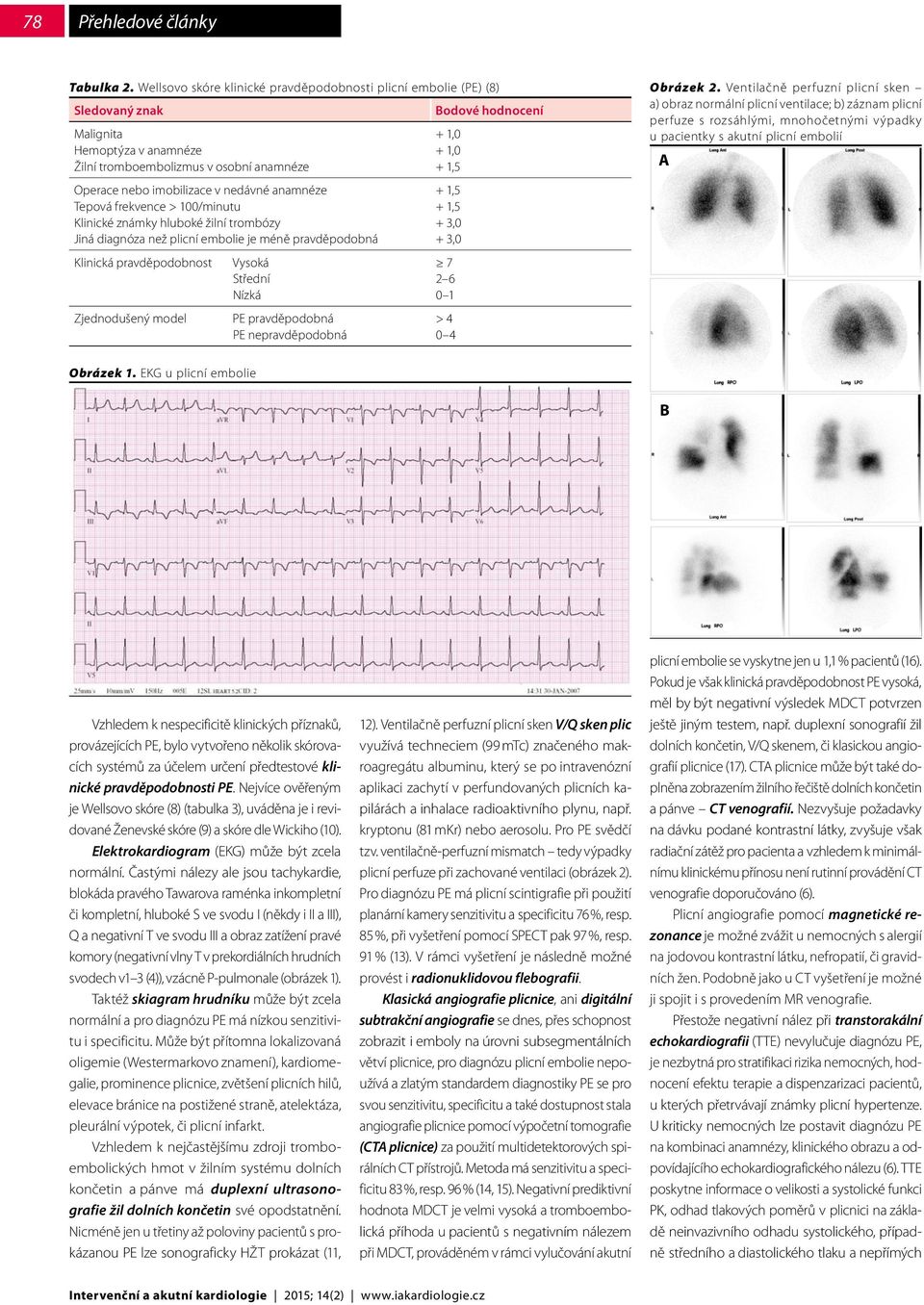 nedávné anamnéze Tepová frekvence > 100/minutu Klinické známky hluboké žilní trombózy Jiná diagnóza než plicní embolie je méně pravděpodobná Klinická pravděpodobnost Vysoká Střední Nízká Zjednodušený