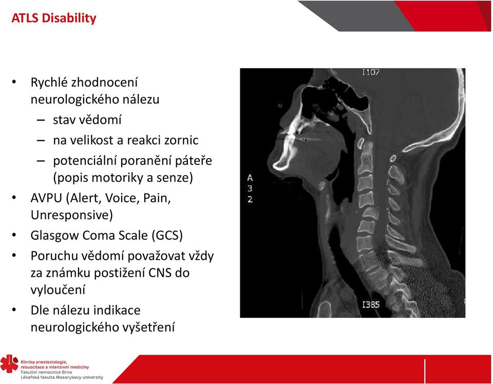 Voice, Pain, Unresponsive) Glasgow Coma Scale (GCS) Poruchu vědomí považovat vždy