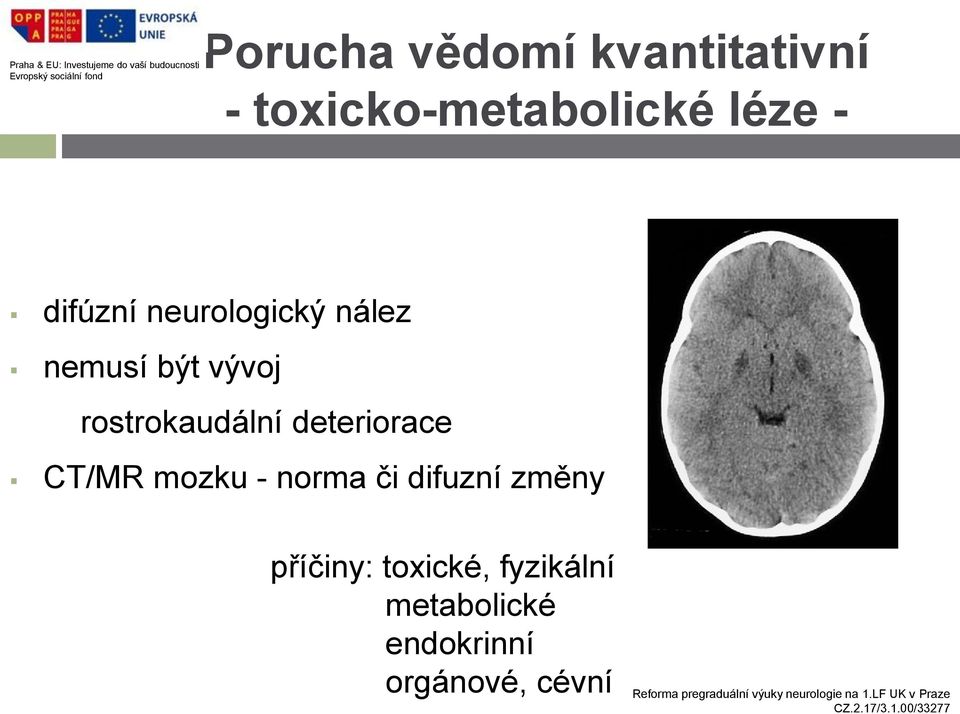 rostrokaudální deteriorace CT/MR mozku - norma či difuzní