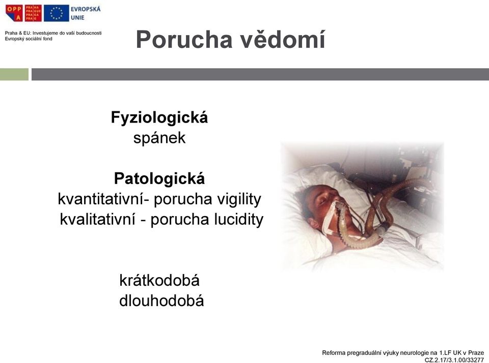 kvantitativní- porucha vigility